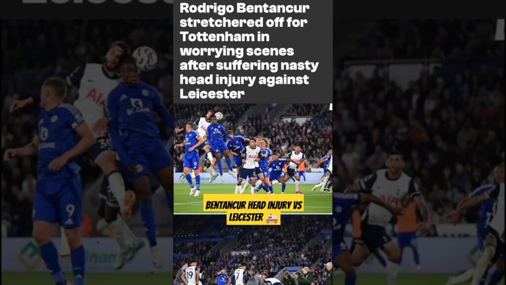 Rodrigo Bentancur Injury vs Leicester 🚑