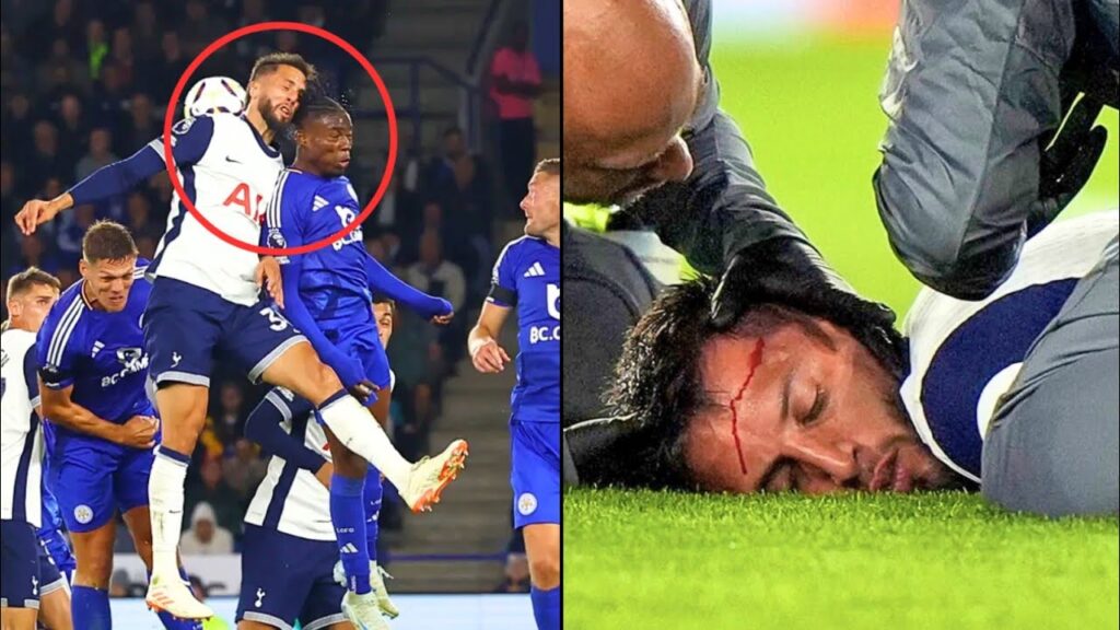 Footage of Rodrigo Bentancur Horrible Head Injury vs Leicester City Today 😢 | Jamie Vardy Goal Spurs