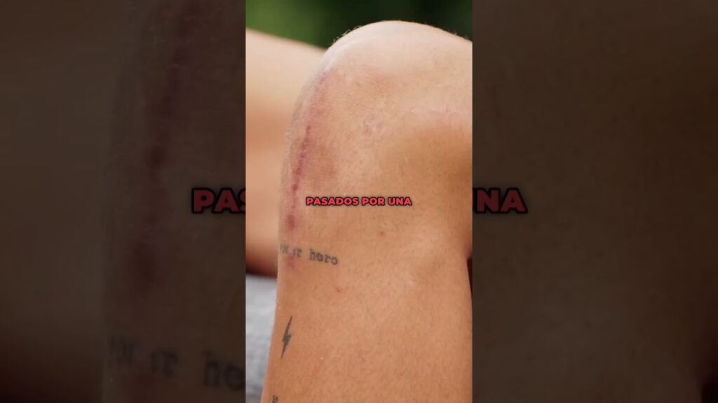 🤕 Yeremy Pino vuelve al Fútbol tras su Lesión de LCA con el Villareal y Selección Española #shorts