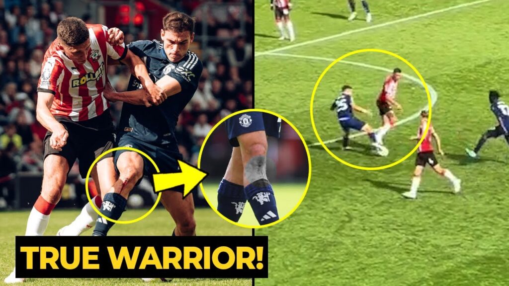 Manuel Ugarte holding his bl**dy knee in PAIN on his DEBUT against Southampton | Man Utd News