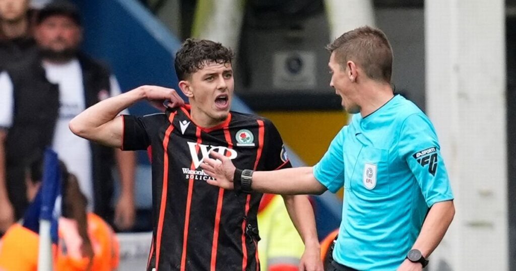 Blackburn left-back Owen Beck shows injury after 'biting' incident