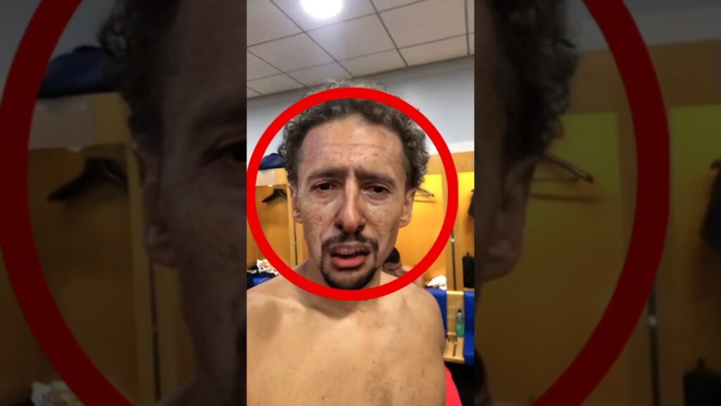 OLHA O QUE ACONTECEU COM O MARQUINHOS 😱 | #shorts