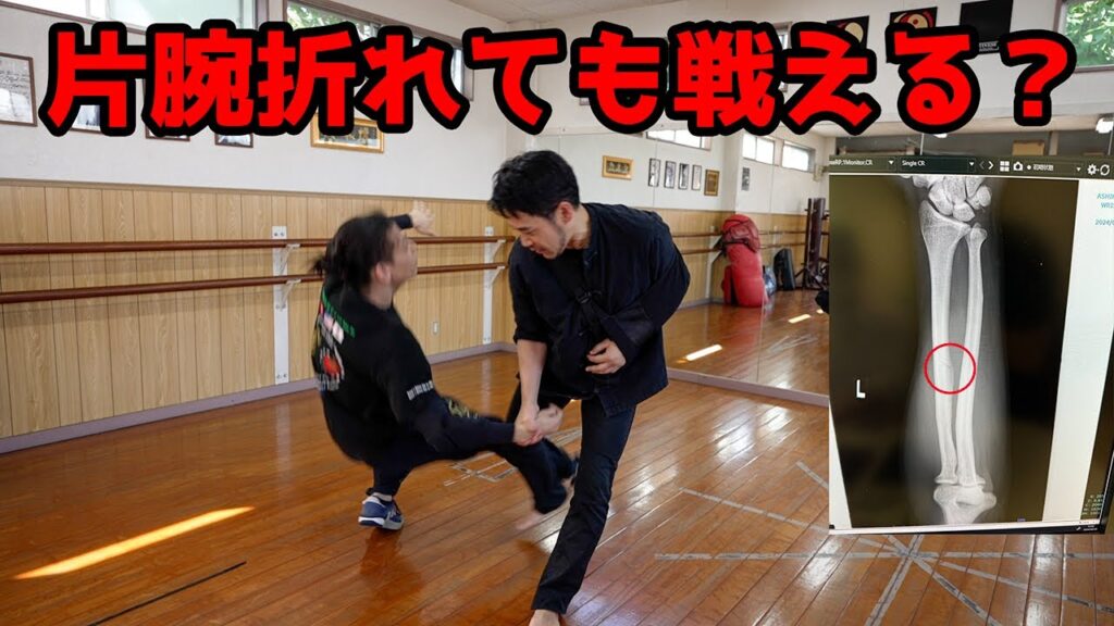 腕を骨折したので稽古をさらに激しくします