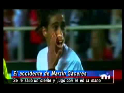 Al "Pelado" le bajaron un diente