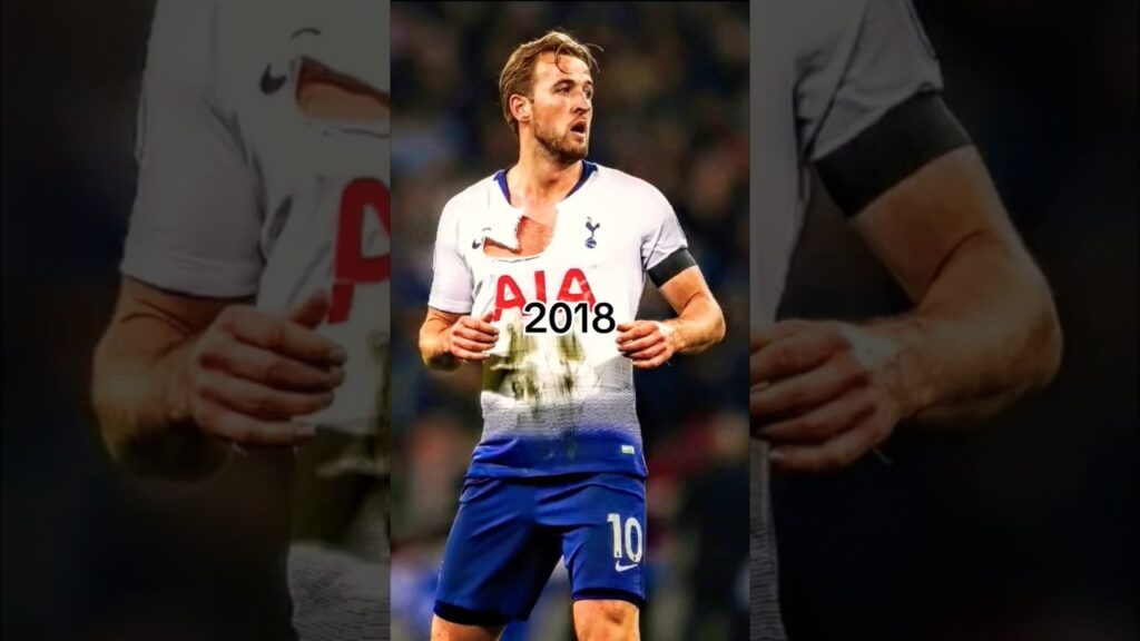 Harry Kane Evolution 🤯