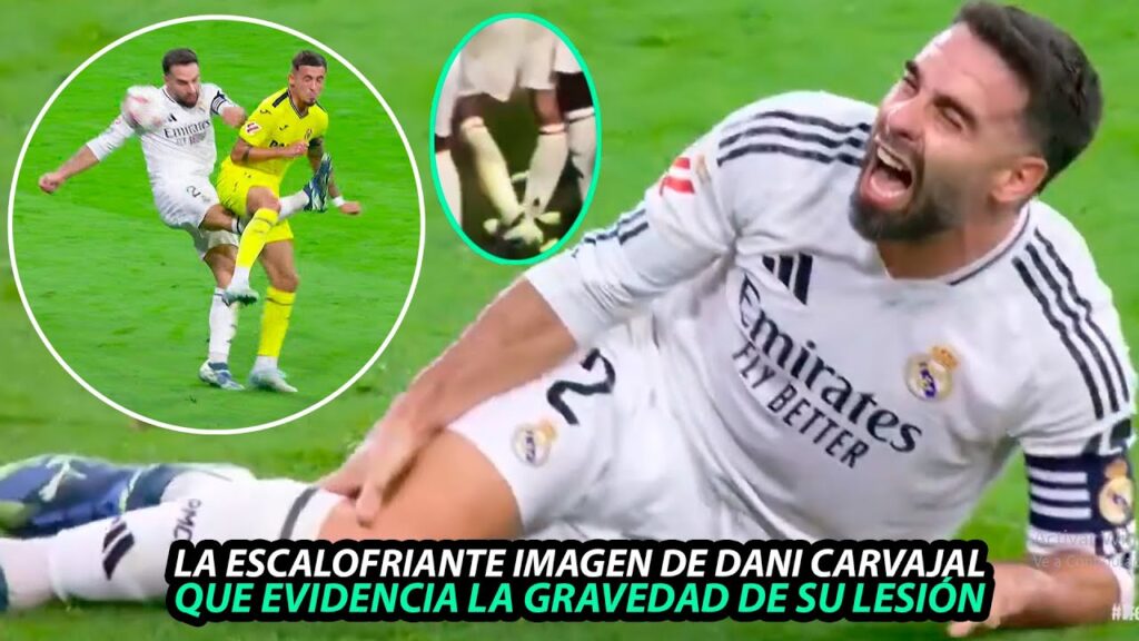 La ESCALOFRIANTE IMAGEN de la LESIÓN de DANI CARVAJAL que EVIDENCIA la GRAVEDAD, LIGAMENTOS CRUZADOS