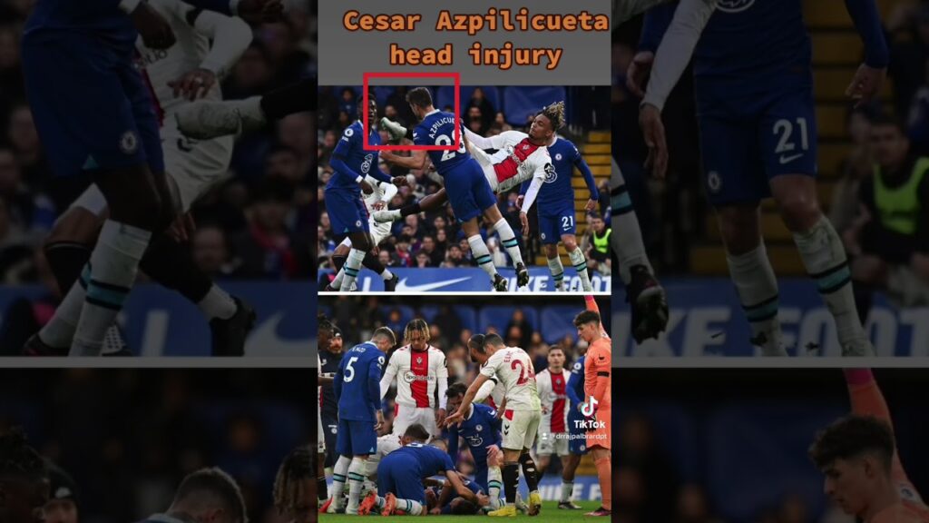 Cesar Azpilicueta head injury. Expert explains | #chelsea #chelseafc #cfc #premierleague #epl