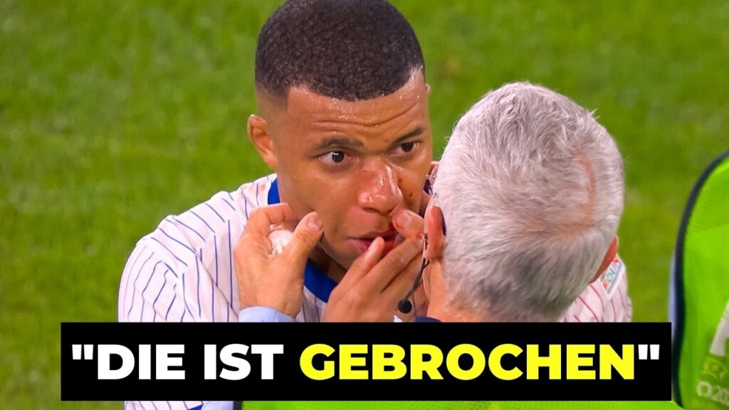 Die UNGLAUBLICHSTEN Momente der Euro 2024!