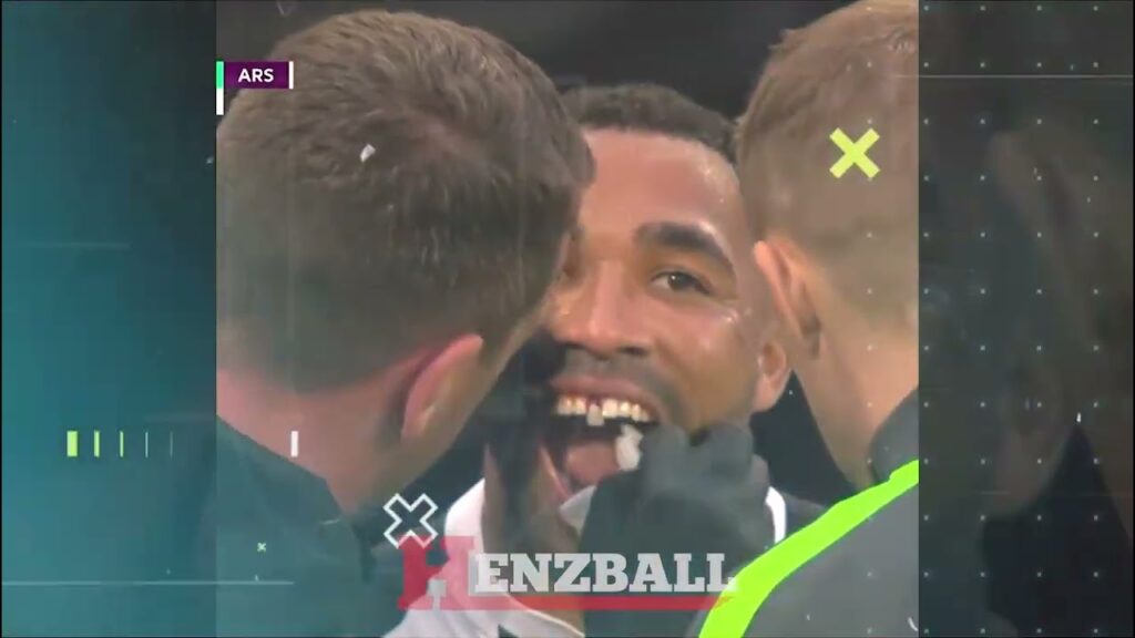 Gruesome moment Callum Wilson's tooth falls vs Arsenal