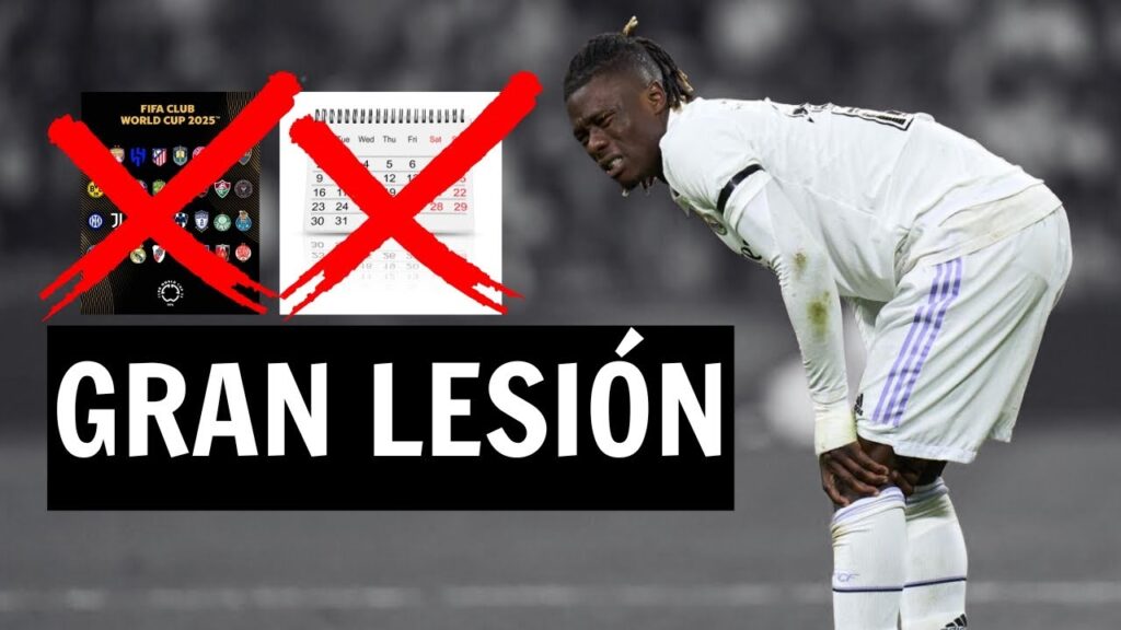 La  lesión de Camavinga es Peor de lo que se Pensaba