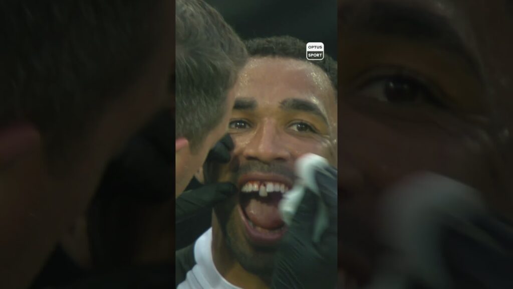 Still thinking about when Callum Wilson became Callum Wilthon 🦷