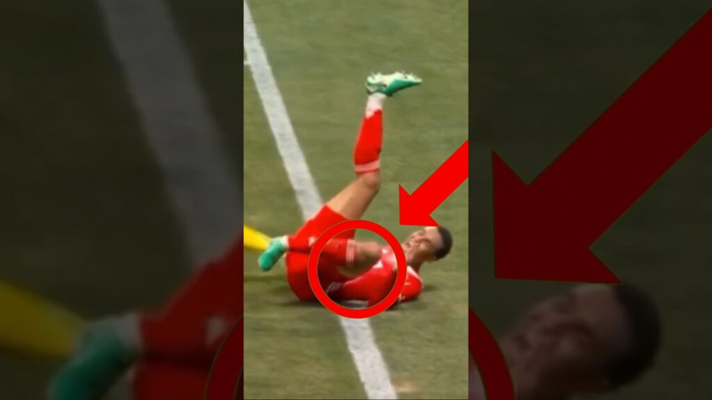 musiala injury| PSG vs Bayern München #shorts #sad #heartbroken #musiala #psg