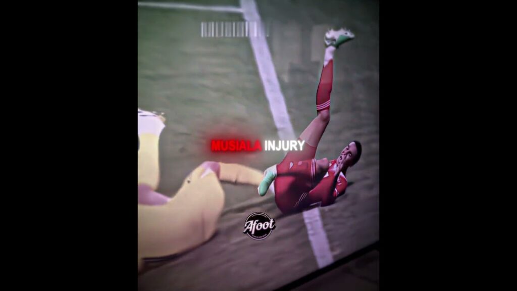 Jamal Musiala Horrific Injury vs PSG