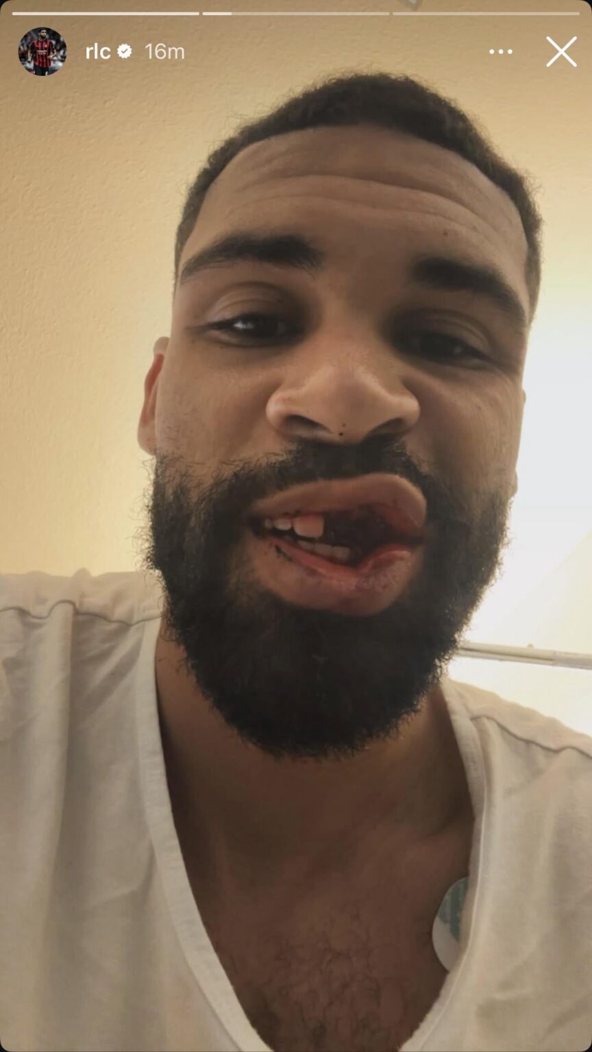 Ruben Loftus-Cheek posts a picture of his injury from yesterday