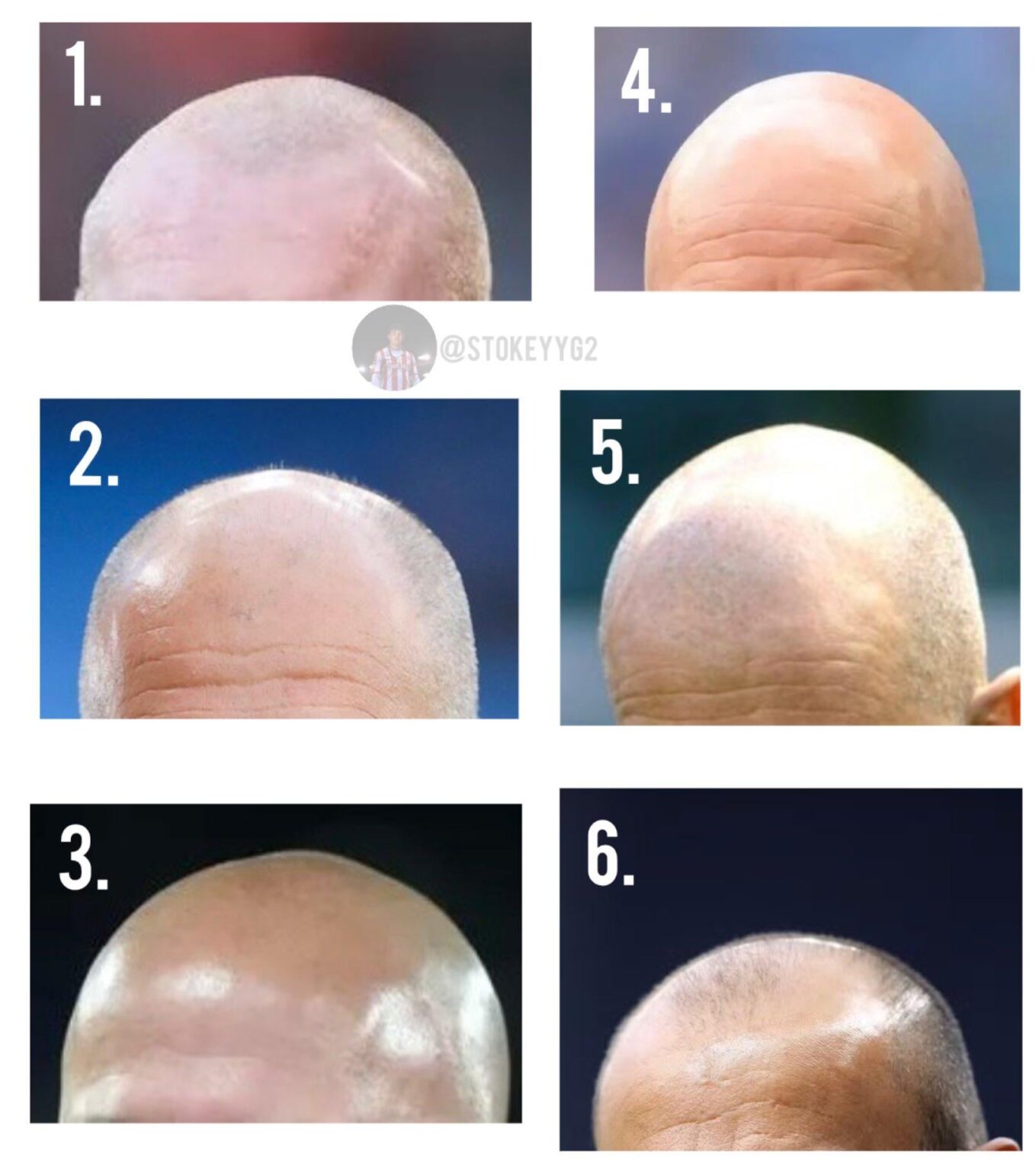 All hail our glorious follically challenged leaders