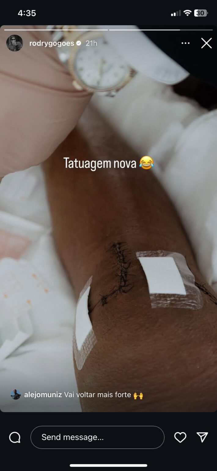 Rodrygo’s knee after his surgery😔