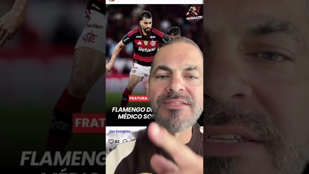 EXAME CONFIRMA FRATURA NA MÃO DIREITA DE LUCAS PAQUETÁ, MAS JOGADOR SEGUE TREINANDO!