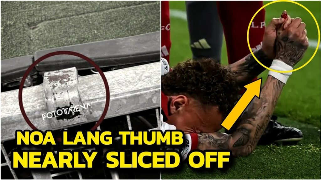 Noa Lang THUMB NEARLY SLICED OFF😱  Horrific Injury vs Liverpool! | Liverpool Vs Galatasaray