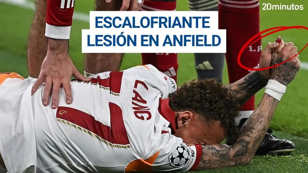 NOA LANG sufre la amputación de un dedo en ANFIELD NOA LANG sufre la amputación de un dedo en ANFIELD