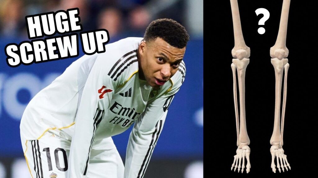 Doctor Explains Kylian Mbappe EMBARRASSING Injury Mistake by Real Madrid