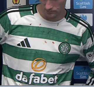 Blood on Čvančara's shirt after fan attack on the pitch