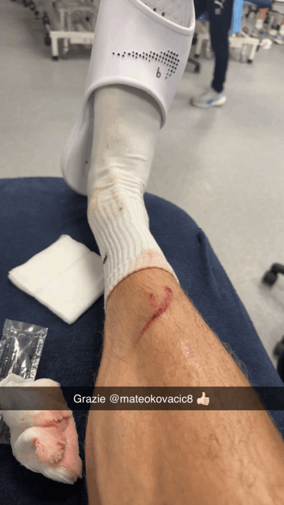 Haaland Injured probably, he posted this story on his Snapchat