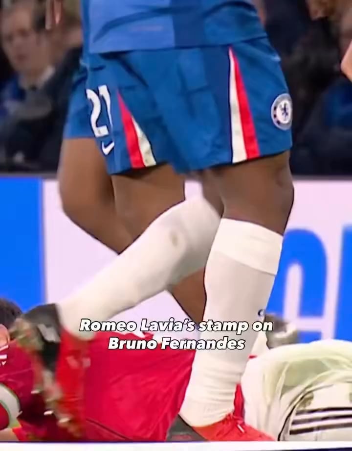 Bruno is stood on by Lavia, no review.