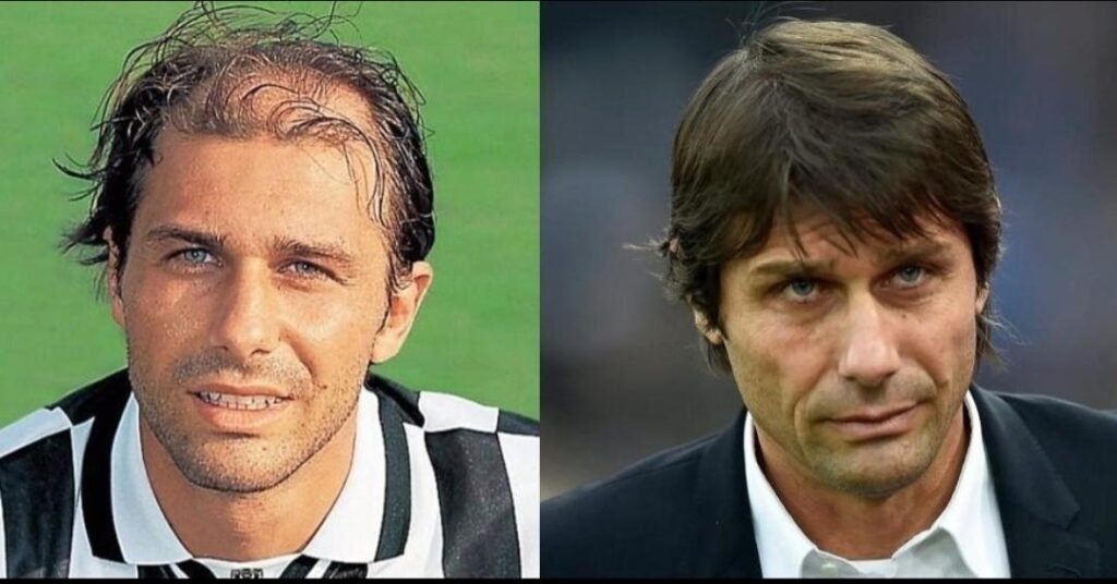 Antonio Conte's hair transformation is unreal